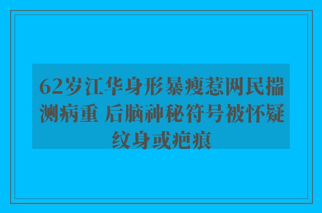 62岁江华身形暴瘦惹网民揣测病重 后脑神秘符号被怀疑纹身或疤痕